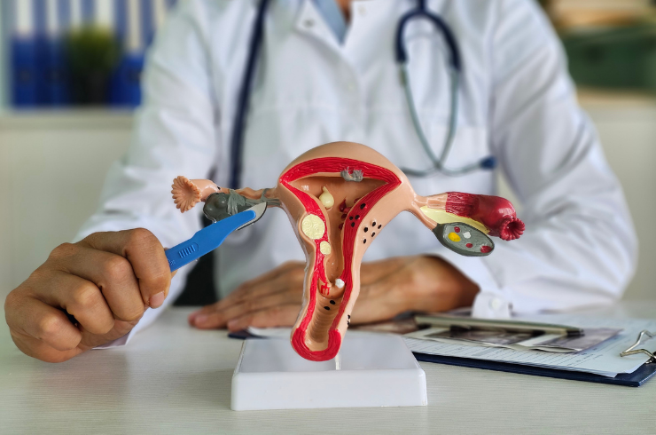 Gynecological Cancer Surgery