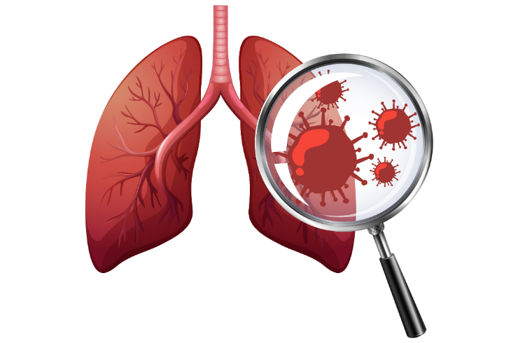 Flexible Bronchoscopy