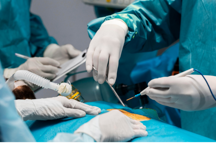 Laparoscopic Surgery